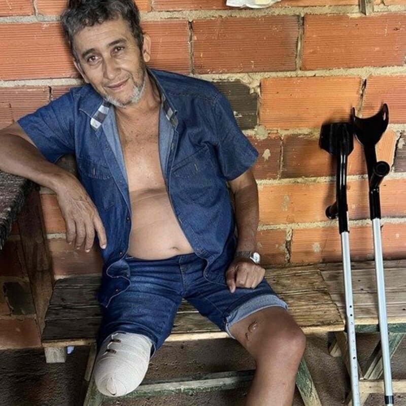 Prótese do Valdivino