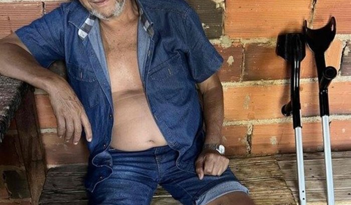 Prótese do Valdivino