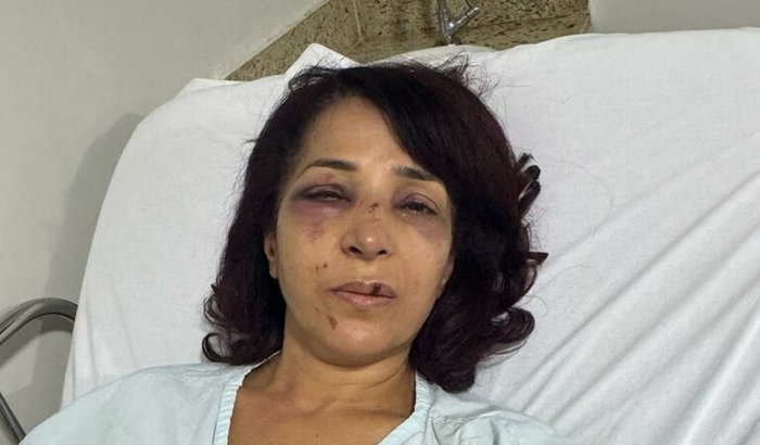 Auxílio para Sandra Abdel