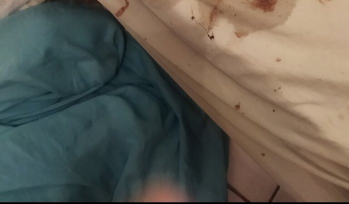 Tratamento pra meu filho que é cego mudo e surdo