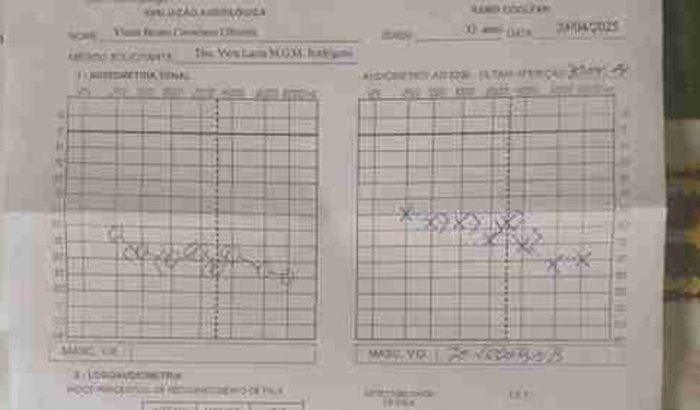 Para comprar 2 aparelhos auditivos 