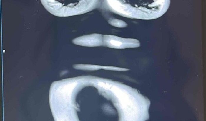 Ajuda para cirurgia 
