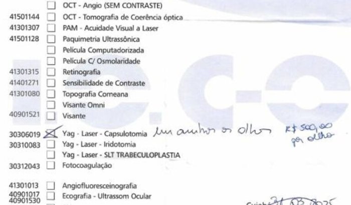 Tratamento de Yag Laser - Capsulotomia