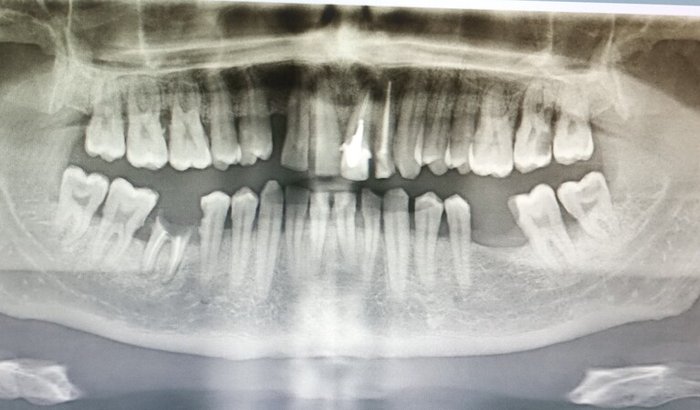 Tratamento urgente odontológico 