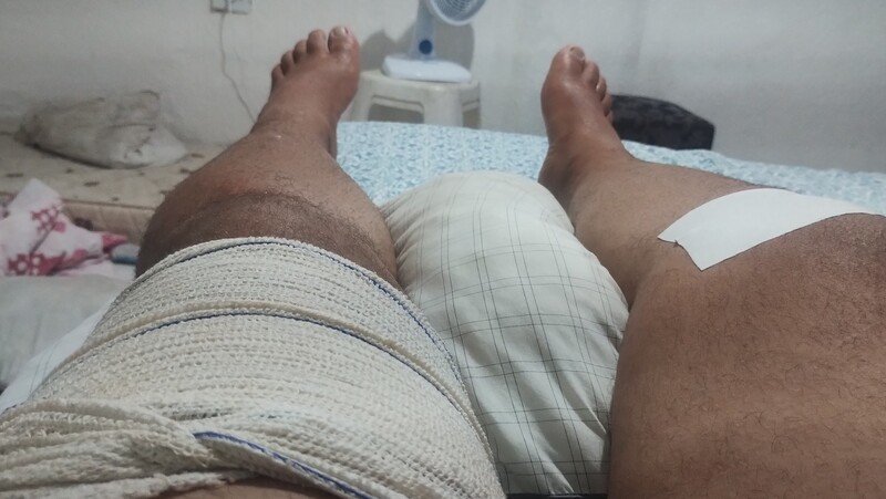 Todos pela cirurgia do Pedro 