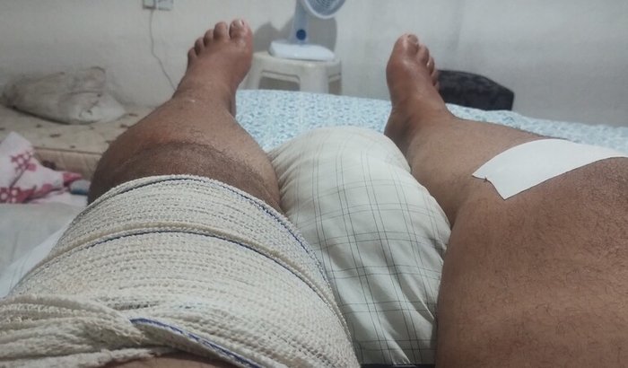 Todos pela cirurgia do Pedro