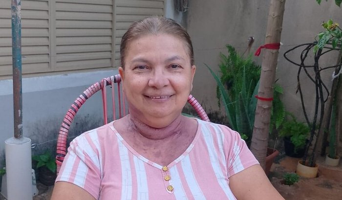 Corrente do Bem: Apoie a Selma no Tratamento do Câncer