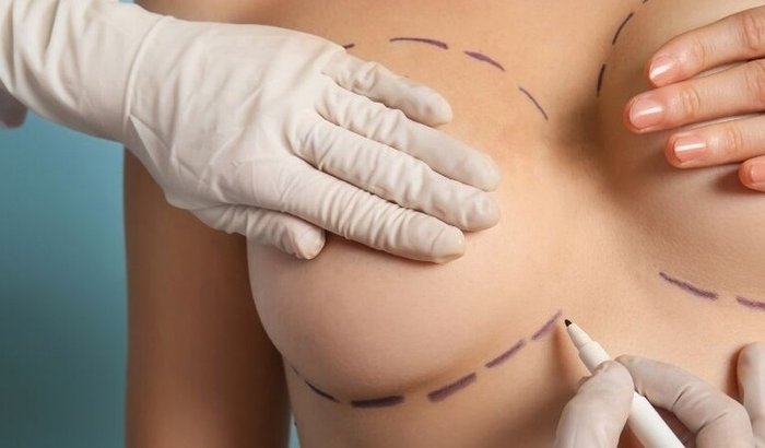 Mamoplastia Redutora / Redução dos Seios