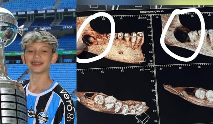 Ajude o Lorenzo a vencer essa luta e recuperar sua saúde!
