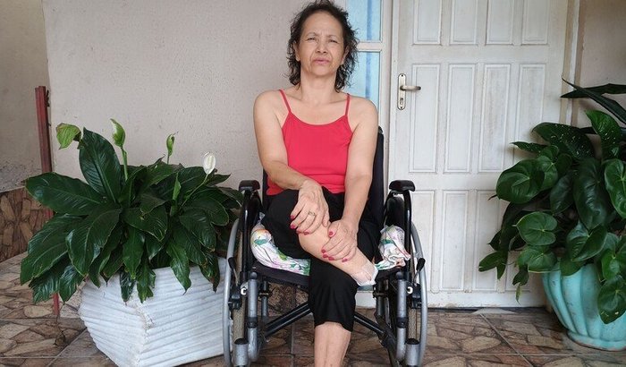Prótese para Rose