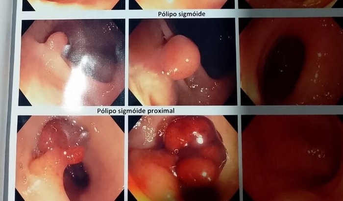 Vaquinha em prol da cirurgia de Genival