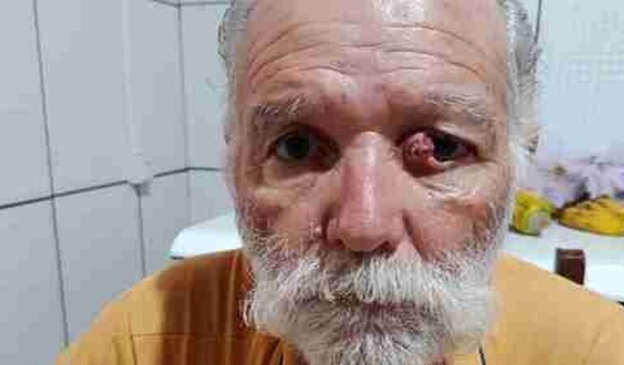Operação Do Juvenal Taxista 