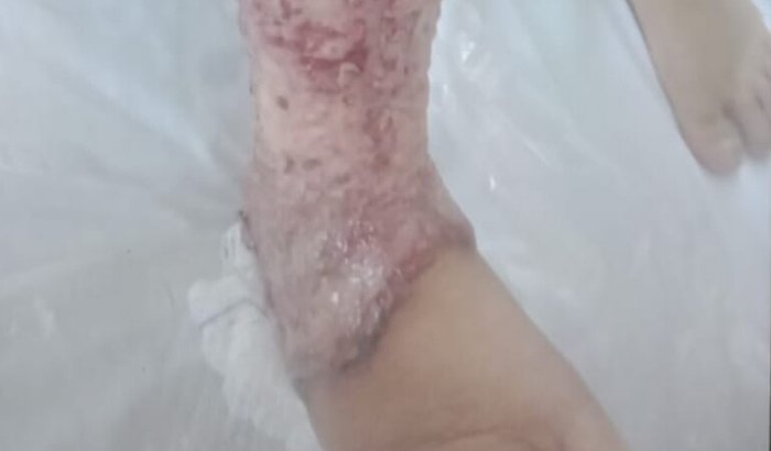 Ajuda com despesas medicas