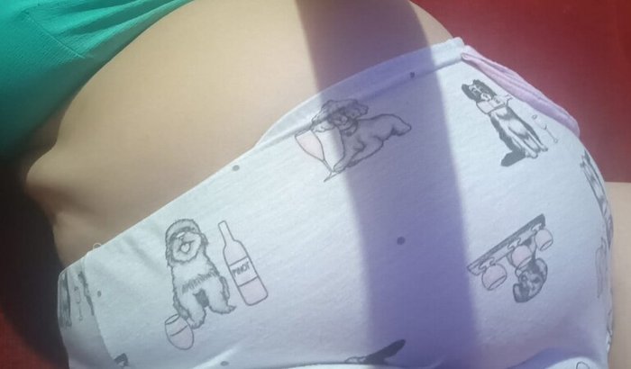 Cirurgia Retirada ovário