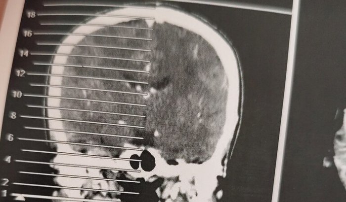 Encontrar um diagnóstico,para começar um tratamento correto 