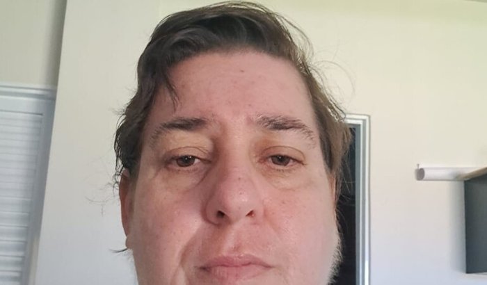 Laine precisa de ajuda urgente para o tratamento de Estenose de Canal Cervical com Compressão de Medula. (URGENTE)