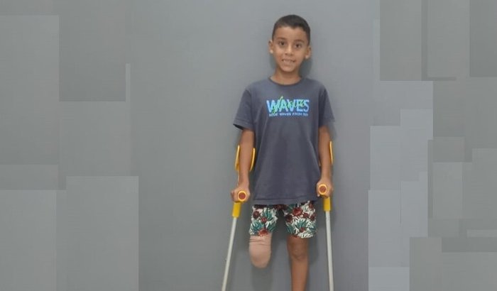 Para futuras manutenção Prótese do Yuri