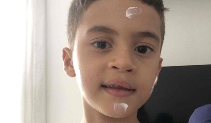 Ajuda custos de Suplementação alimentar de Anthony!