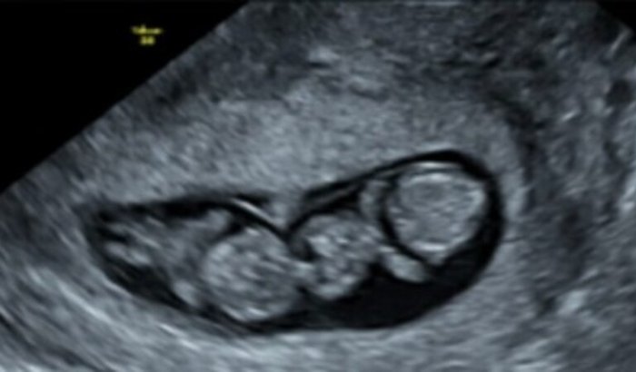 Chá de Fralda do Miguel e Théo