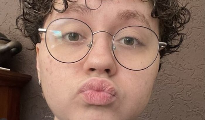 Mastectomia Masculinizadora do Theo 🏳️⚧️💙