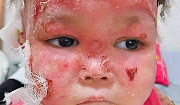 🌸 Ajude a pequena Maria Eduarda no tratamento