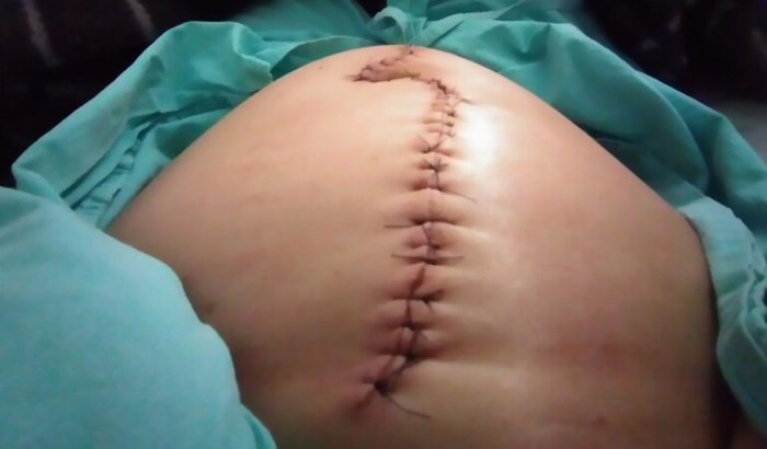 Me ajude a recomeçar