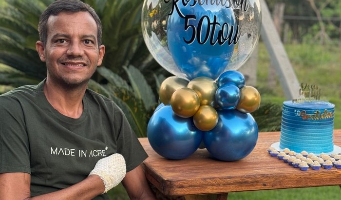 Próteses das pernas e mãos de Rosenilson 