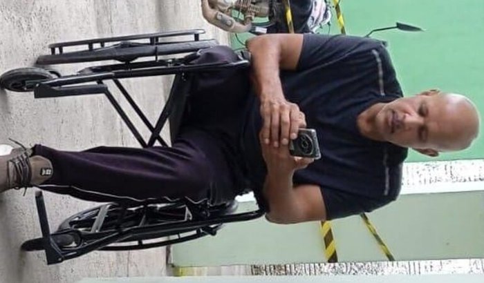 Prótese transfemural proximal