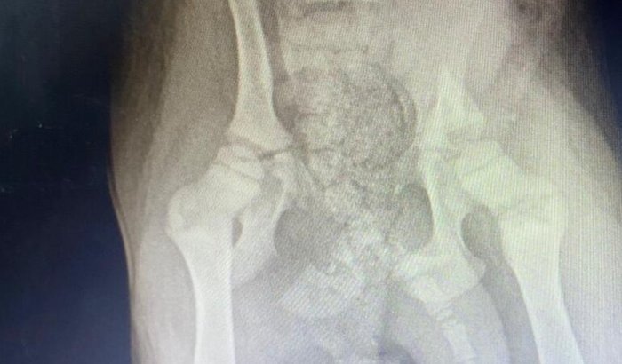 Me ajuda no tratamento de uma cadelinha de 3 meses q foi atropelada na minha frente  frente 