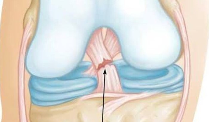 Ajuda para pagar minha cirurgia no joelho