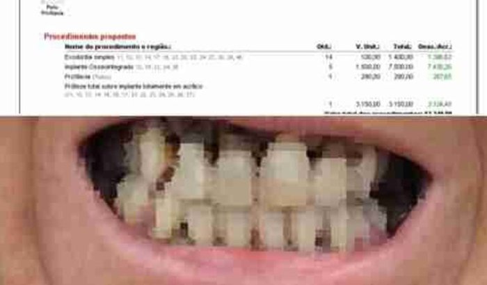 Urgente! Tratamento Odontológico com perda óssea