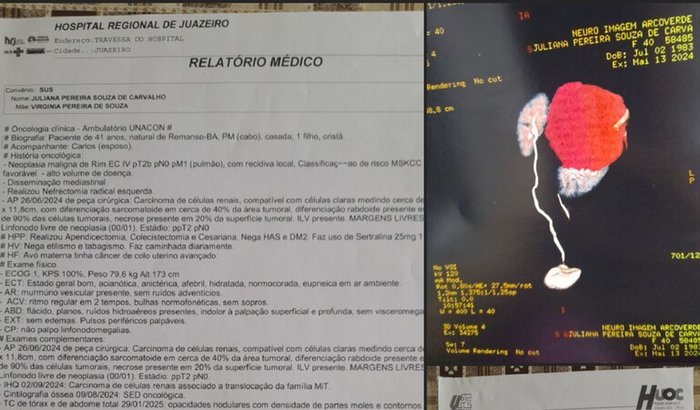 Comprar medicação oncológica (Sunitinibe 50 mg)