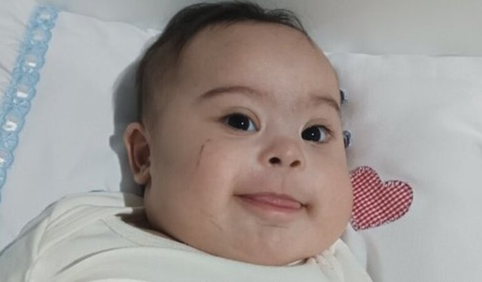 Tratamento do Calebe