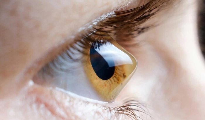 Ajudar com uma parte de uma cirurgia transplante de cornea 