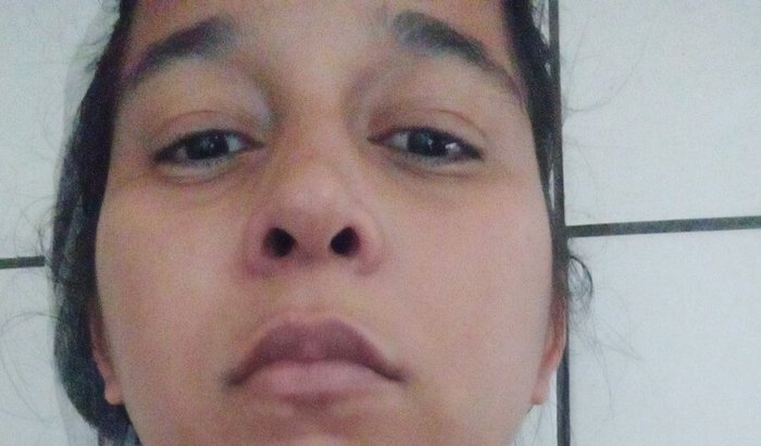 Tratamento e cirugia pra varizes pélvicas