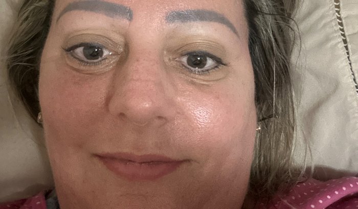 Laila : Neuromelite optica rara🧡💚