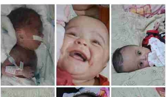 Ajuda na ressonância magnética crânio da Dhiulia mariah