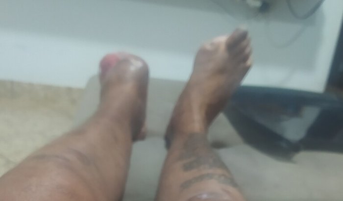 Dispensas, remédios