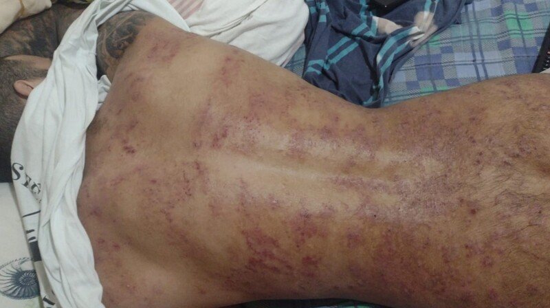 imagem da vaquinha AJUDE MEU FILHO MOISÉS