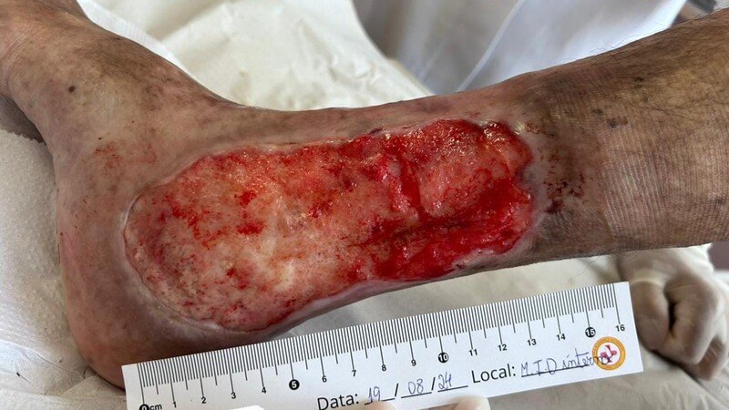 imagem da vaquinha Materiais para curativos