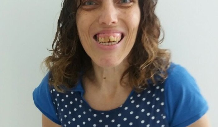 Ajuda pode devolver a visão dela