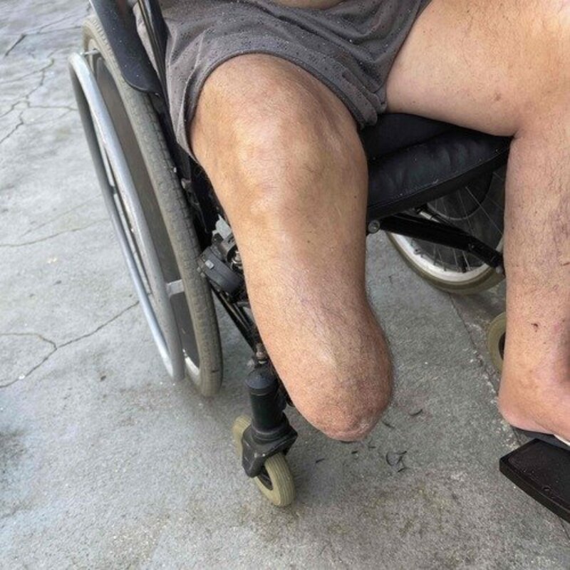 imagem da vaquinha Ajuda para comprar uma prótese para o meu pai Celso Gomes 