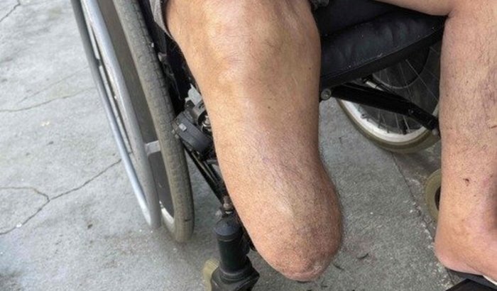 Ajuda para comprar uma prótese para o meu pai Celso Gomes 