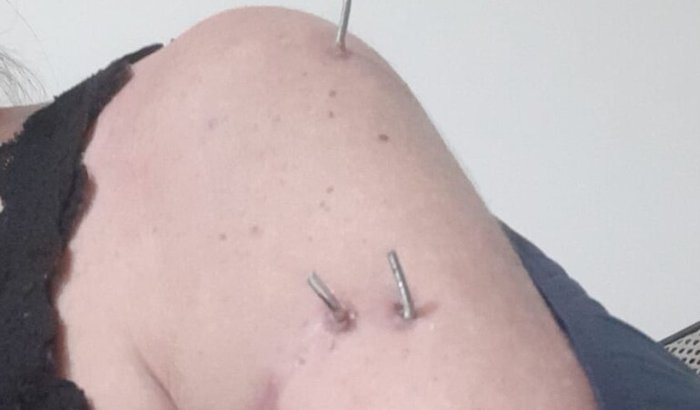 Ajuda com fisioterapia 