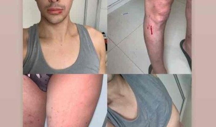 Recomeço para o começo da Yara