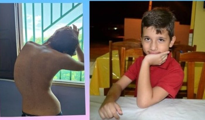 10 ANOS DORES DEFORMIDADES/CIRURGIA