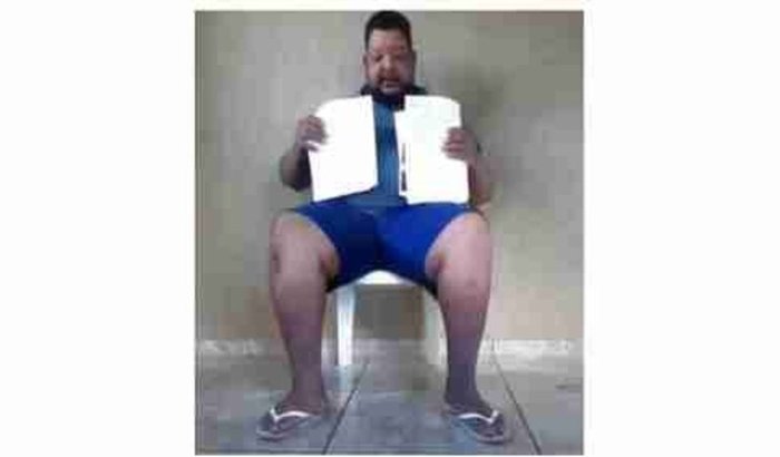 Cirurgia Bariátrica para o Guilherme