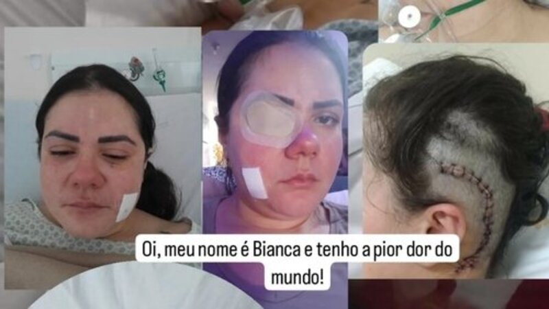 A pior dor do mundo (Neuralgia dos Trigêmeos)