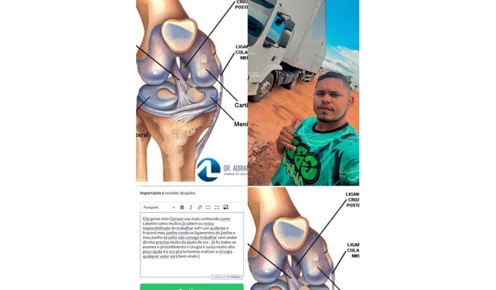 Cirugia joelho Gerson cabelim