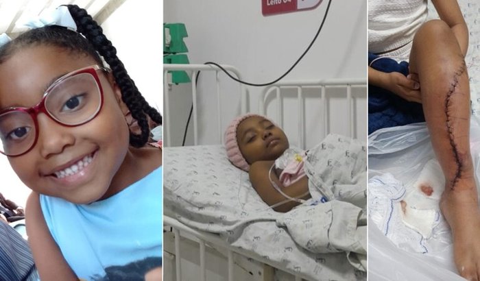 Ajude a Maria Alice de 8 anos com câncer nos ossos